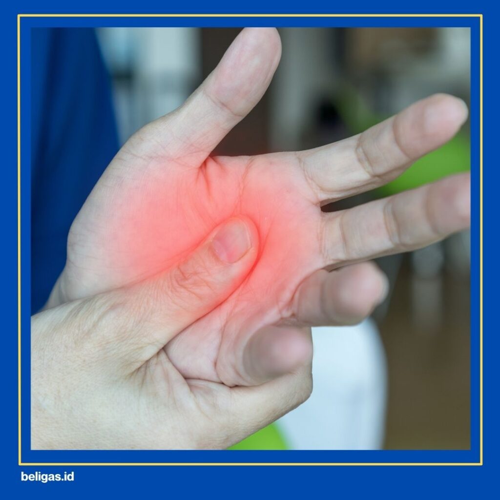 Anti Inflamasi Steroid