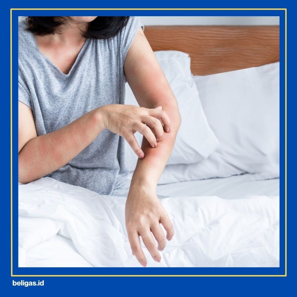 Efek Samping Obat Non Steroid